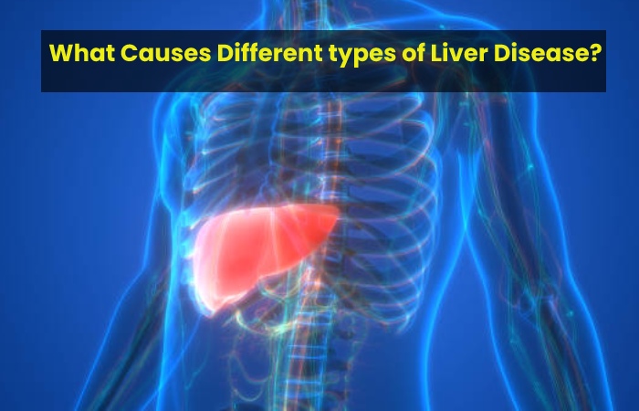 What Causes Different types of Liver Disease?