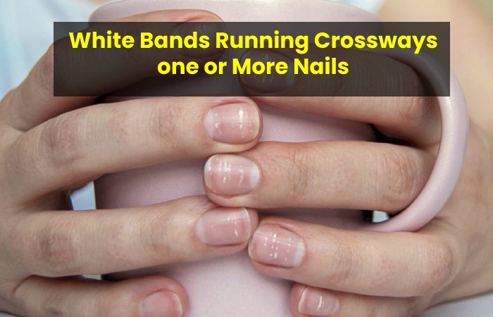 White Bands Running Crossways one or More Nails